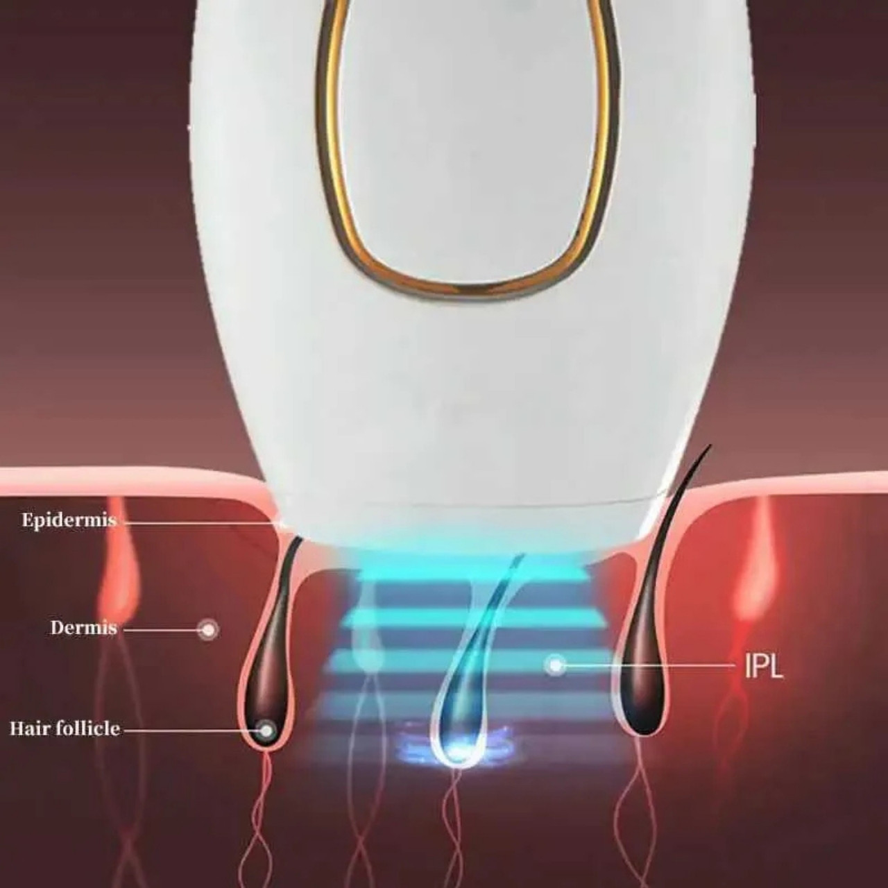 IPLStar, laser hair removal device - Image 9