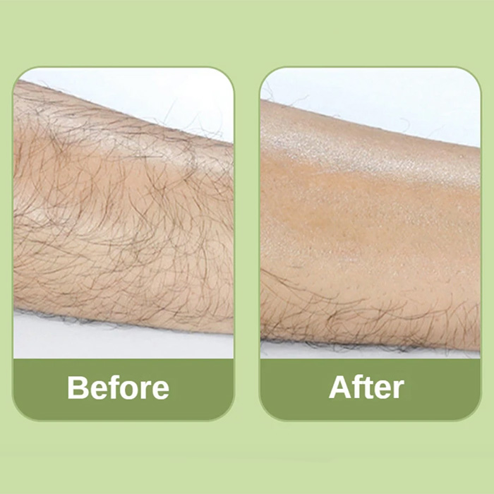 SoftSkin, kryštáľový odstraňovač chĺpkov, ktorý znižuje a spomaľuje rast chĺpkov - Image 5