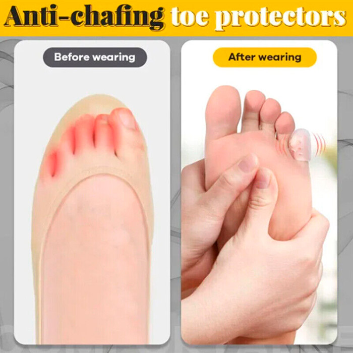 ToeProtector, silikónové chrániče prstov (10 kusov) - Image 5