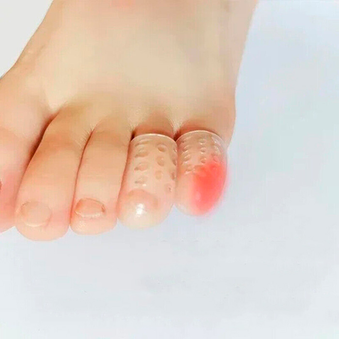 ToeProtector, silikónové chrániče prstov (10 kusov) - Image 8
